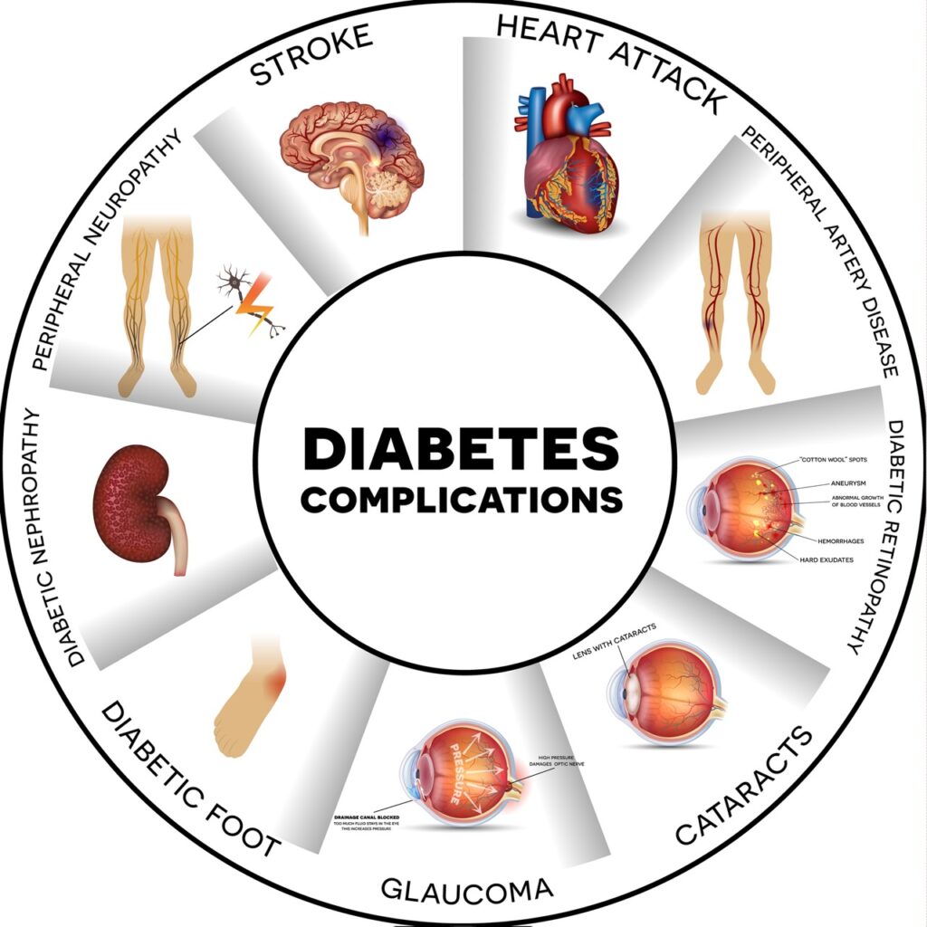 Diabetes complications infographic